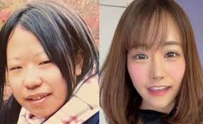 7일 파업 앞두고, 전국 전공의 실명 하나하나를 밝힌 '젊은 의사들의 성명서'가 공개됐다. 4ë²ˆ ì„±í˜•ìœ¼ë¡œ ì–»ì€ ê±´ æ—¥ ì—¬ì„±ì˜ ì‚¬ì—° ë„¤ì´íŠ¸ ë‰´ìŠ¤