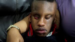 DeafBlind and Intellectually Disabled (Learn How to be his Friend)