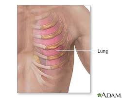 Rib cage pain can have many different causes ranging from primarily a nuisance serious. Costochondritis Information Mount Sinai New York