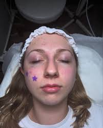 Square 180 degree haircut!