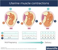 The Physiological Difference Between Braxton Hicks And Labor Contractions Contractions Labor Braxton Hicks Contractions