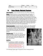 8 What Bones Are Most Vulnerable To Osteoporosis And Why Hip Spine And Wrist Course Hero