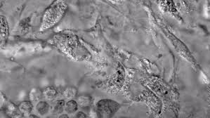 Check spelling or type a new query. Scientists Debate The Origin Of Cell Types In The First Animals Quanta Magazine
