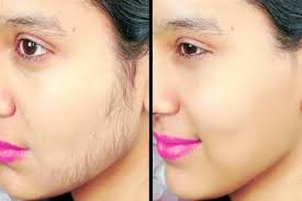 Genetic history, hormonal imbalance, aging, and more could be the reason for facial hair growth. 10 Effective Facial Hair Removal Methods Understand And Learn About All Of Them Hergamut
