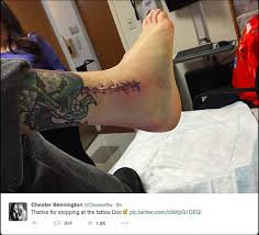 Here is a look at some of his body art.if you. Linkin Park S Chester Bennington Posts Gnarly Post Surgery Photo