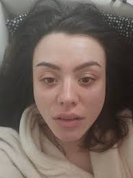 Age -22 Medicine Taking