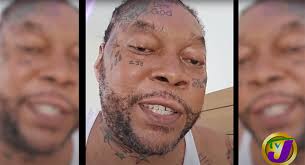 Kartel considers SVG for 'best treatment possible' for Grave's disease