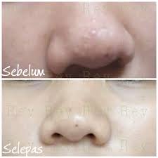 Mari cuba cara yang kami senaraikan ini. Biji Kolestrol Removal Cream Shopee Malaysia