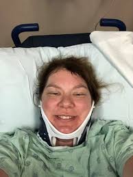 Melissa's Helmet Crusade