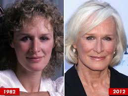 Glenn Close: Good Genes or Good Docs?
