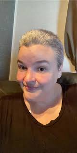 Corning doesn't have cold capping machine for chemo