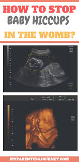 Pin On Pregnancy Health And Wellness