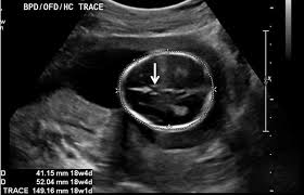 Institute For Advanced Medical Education Obstetric Ultrasound Sonography Medical Education