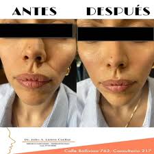 Dr Julio Limon (@drjuliolimon) • Instagram photos and videos