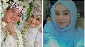 Seperti yang diberitakan sebelumnya, rizki dan nadya menikah pagi tadi sekitar pukul 09.00 wib di bandung. Fakta Fakta Menarik Sosok Nadya Mustika Rahayu Betapa Beruntung Rizki Dacademy Lihat Profesinya Tribunnewsmaker Com