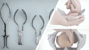 Image result for Forceps Assisted Delivery