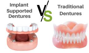 What is the cost of replacing all teeth with good dental implants like the historic alternatives to missing teeth have been dentures or bridges but these are not without their problems. Implant Supported Dentures What You Need To Know The Geriatric Dietitian