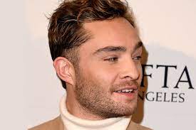 Für diejenigen, die hohe stirn haben, ist die minimierung der darstellung. Geheimratsecken Kaschieren Gq Germany