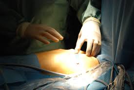Doktor Mustafa Yuksel Ruhun Pektus