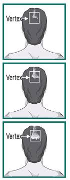 We did not find results for: Minoxidil Topical Solution 2 For Men