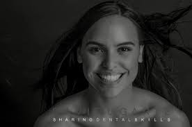 Enamelast es un Barniz de Flúor a base de Fluoruro de sodio al 5%,  saborizado y endulzado con Xilitol, produce una obliteración mecánica de  los túbulos dentinarios en el tratamiento de la