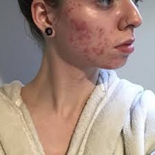 TOP 10 BEST Coolsculpting in Floyds Knobs, IN