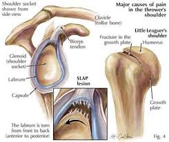 Pt Tip Of The Month Archive Slap Lesions Shoulder Surgery Recovery Physical Therapy Exercises Shoulder Anatomy