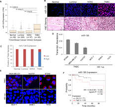 They help to screen for cancers even. Microrna 138 Is A Prognostic Biomarker For Triple Negative Breast Cancer And Promotes Tumorigenesis Via Tusc2 Repression Scientific Reports