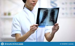 Medico Femea Que Olha Atentamente Os Pulmoes Raio X Risco De Bronquite Saude Imagem De Stock Imagem De Pneumonia Trabalhador 154248705