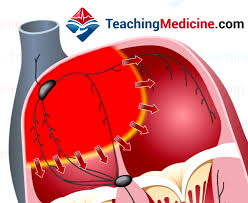 Image result for P Wave