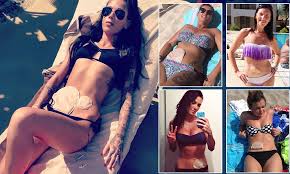 Crohn S Disease Sufferers Have Shared Selfies With Their Colostomy Bags Daily Mail Bethany News Newslocker