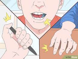 Maybe you would like to learn more about one of these? 4 Ways To Deal With Misophonia Wikihow