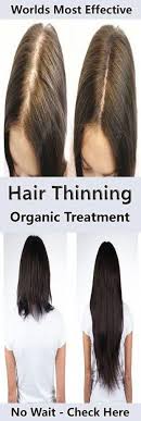 But the truth is that you can opt for longer hairstyles safely, as there is an array of tricks that help visually correct the sparseness while accentuating the. Losing Hair Hairlossno Hair Growth For Men Hairstyles For Thin Hair Hair Loss Women