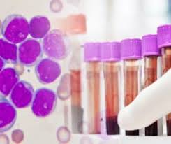 Check spelling or type a new query. Leucemia Fulminante Leucemia Promielocitica Acuta