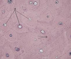 Compact bones make up 80 percent of the human skeleton; File Compact Bone Decalcified Cross Section Jpg Wikibooks Open Books For An Open World