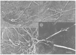 Image result for Uncinula necator