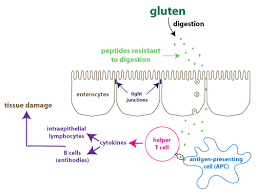 Celiac Disease