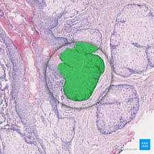 Image result for Sebaceous Gland