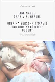Sectiomalzwei Eine Narbe Eine Geschichte Und Ganz Viel Gefuhl Naturliche Geburt Geburt Geburt Kind