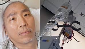 김철민은 17일 오후 전파를 탄 tv조선 '탐사보도 세븐'에 출연해 근황을 밝히고 펜벤다졸 복용 전후를 비교한 ct 결과를 공개했다. Oykibxswardjim