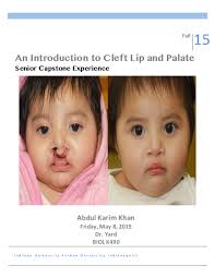 PDF) An Introduction to Cleft Lip and Palate Senior Capstone Experience