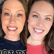 Soooo.... I did a thanggg! B▪️O▪️T▪️O▪️X. Big shout out to my girl 💕Olivia  Rodgers 💕at Blush Aesthetics! If you have every considered it..... go see  my girlfriend! It's quick..... nearly painless.... and