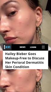 Thank you @haileybieber @enews for speaking out about your struggles with  perioral dermatitis !