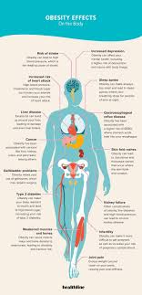 The Effects Of Obesity On Your Body In 2020 Obesity Body Childhood Obesity