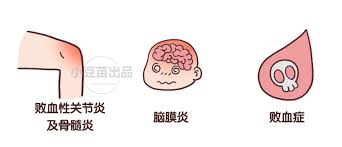 4 / 13 医药生物·专题报告 请务必阅读正文后免责条款 一、新兴市场是gsk 疫苗发展长期战略 1.1 葛兰素史克公司（gsk）疫苗业务稳步成长 gsk 简介 葛. è‡ªè´¹ç–«è‹—ä¸æ˜¯å›½å®¶å…è´¹æä¾›çš„ å®‰å…¨æ²¡ä¿è¯ å°è±†è‹—ç–«è‹—åŠ©æ‰‹