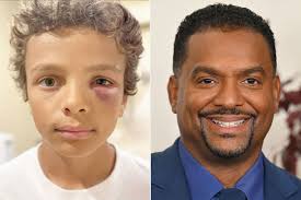 Alfonso Ribeiro Reveals New Details About Son AJ's Black Eye: 'It's Part of  Baseball' (Exclusive)