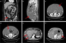 Image result for Pseudoeriosema