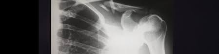 In fact, practicing yoga asana may very well get rid of a. How Yoga Can Wreck Your Body A Response Rachel Scott
