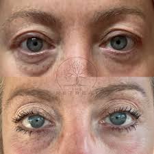 Teri Steele (@aestheticsnrsteri) • Instagram photos and videos