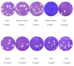 Image result for Neutralization Test